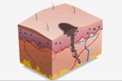 Melanoma | Recurso educativo 45057