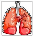 Bronquiectasias y atelectasia | Recurso educativo 76235